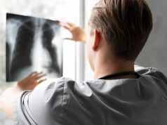 Anvisa aprova mais um produto para tratamento de câncer de pulmão