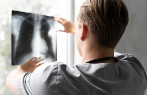 Anvisa aprova mais um produto para tratamento de câncer de pulmão