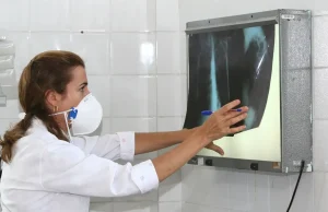 OMS recomenda testes de diagnóstico rápido para erradicar tuberculose