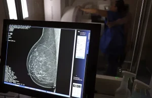 É lei: trabalhador tem direito a 3 folgas por ano para exames preventivos