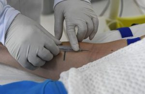 MS segue há 7 anos sem casos confirmados de hantavirose, reforça SES