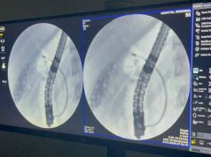 Exame inédito marca avanço da alta complexidade no Hospital Regional de Dourados