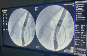 Exame inédito marca avanço da alta complexidade no Hospital Regional de Dourados