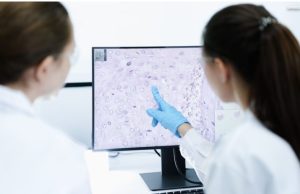 Anvisa aprova novo medicamento para linfoma não Hodgkin