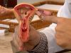 Aberta chamada pública para pesquisas sobre endometriose